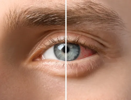 Entorno natural ideal para reposo ocular